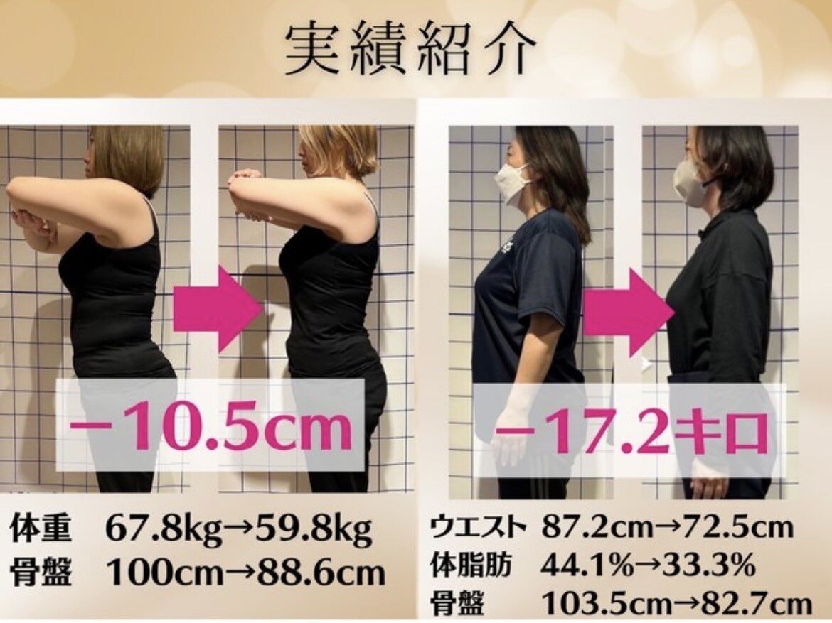 産後骨盤矯正